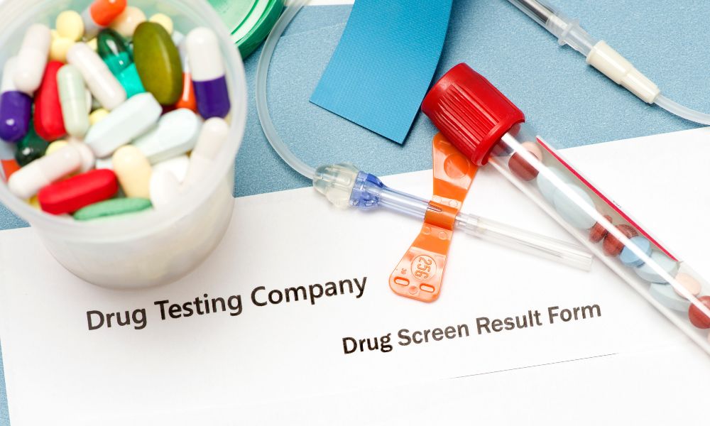 What To Do if an Employee Fails a Drug Test
